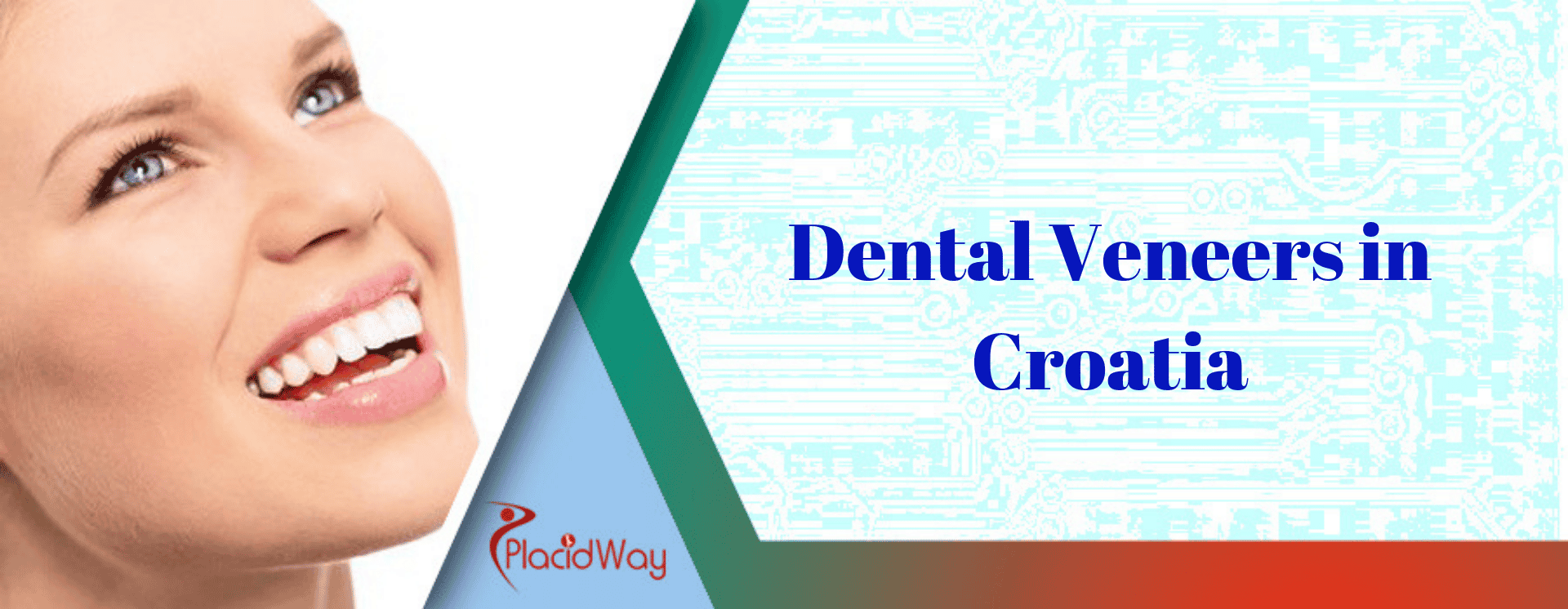 Dental Veneers in Croatia